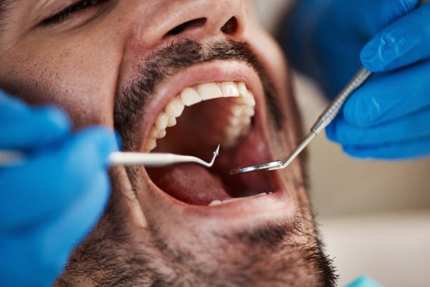 Best Dentist for Tooth Abscess  in Dover, OH