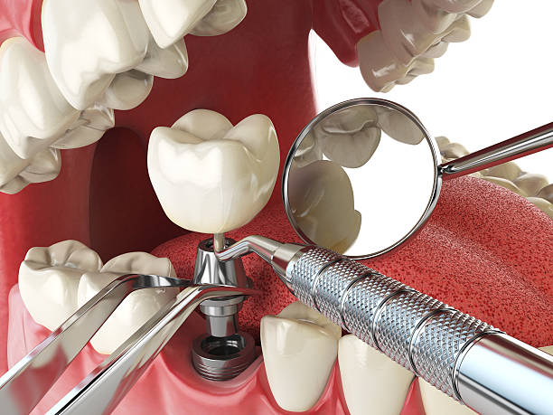 Best Teeth Whitening  in Dover, OH